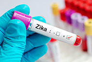 Zika blood in test tube