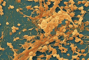 Identifying and eradicating biofilm