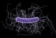 Despite progress, more work needed on infections