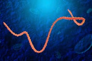 Survey shows hospital staff are better trained to confront Ebola